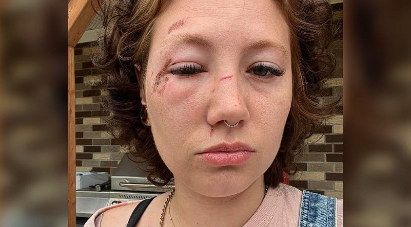 吓人！魁省惊现多起迷药案，女子在节庆活动上一杯饮料下肚立马瘫软