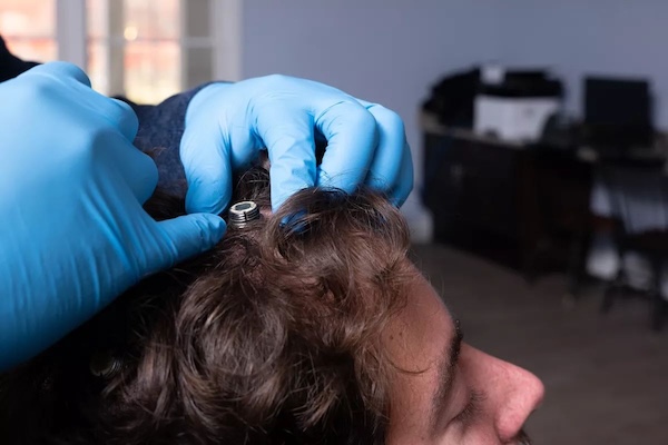 意念操控新时代！加拿大医疗界迎来一项震撼突破